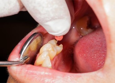 Endodontie
